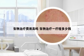 生物治疗费用高吗 生物治疗一疗程多少钱