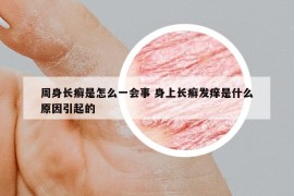 周身长癣是怎么一会事 身上长癣发痒是什么原因引起的