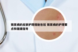 银屑病的皮肤护理措施包括 银屑病的护理要点和健康指导