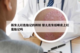 新生儿红色胎记的辨别 婴儿出生后眼皮上红是胎记吗