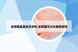 皮研霜是激素药膏吗 皮研霜可以长期使用吗