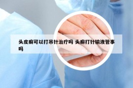 头皮癣可以打吊针治疗吗 头癣打针输液管事吗