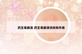 药王毒癣清 药王毒癣清功效和作用