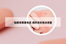 贴癣膏那里有卖 癣药膏的用法用量