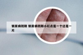 银屑病初期 银屑病初期小红点是一个还是一片