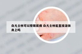 白凡士林可以擦银屑病 白凡士林能直接涂抹身上吗