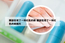 腰部出现了一块红色的癣 腰部出现了一块红色的癣图片