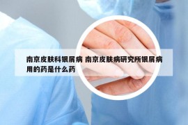 南京皮肤科银屑病 南京皮肤病研究所银屑病用的药是什么药