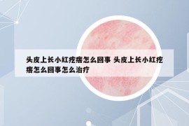 头皮上长小红疙瘩怎么回事 头皮上长小红疙瘩怎么回事怎么治疗