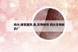 四川,哪家医院,有,生物制剂 四川生物制药厂