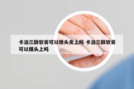 卡泊三醇软膏可以擦头皮上吗 卡泊三醇软膏可以摸头上吗