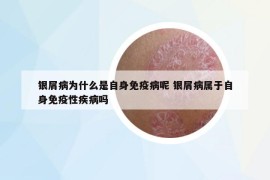 银屑病为什么是自身免疫病呢 银屑病属于自身免疫性疾病吗