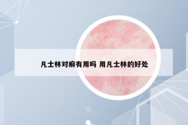 凡士林对癣有用吗 用凡士林的好处