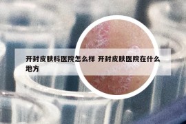开封皮肤科医院怎么样 开封皮肤医院在什么地方