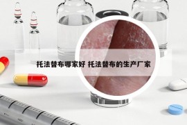 托法替布哪家好 托法替布的生产厂家