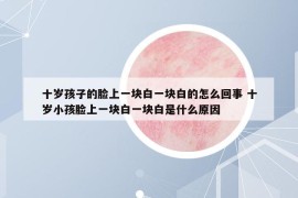 十岁孩子的脸上一块白一块白的怎么回事 十岁小孩脸上一块白一块白是什么原因