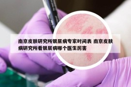 南京皮肤研究所银屑病专家时间表 南京皮肤病研究所看银屑病哪个医生厉害