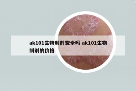 ak101生物制剂安全吗 ak101生物制剂的价格