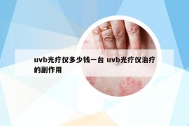 uvb光疗仪多少钱一台 uvb光疗仪治疗的副作用
