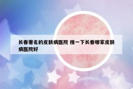 长春著名的皮肤病医院 搜一下长春哪家皮肤病医院好