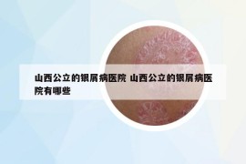 山西公立的银屑病医院 山西公立的银屑病医院有哪些