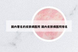 国内著名的皮肤病医院 国内皮肤病医院排名