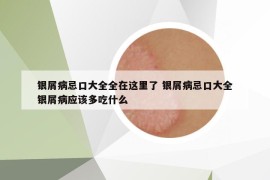 银屑病忌口大全全在这里了 银屑病忌口大全银屑病应该多吃什么