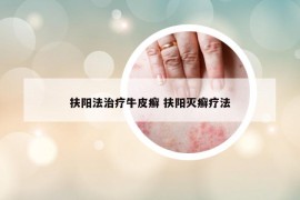扶阳法治疗牛皮癣 扶阳灭癣疗法