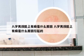 八岁男孩脸上有癣是什么原因 八岁男孩脸上有癣是什么原因引起的