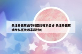 天津看银屑病专科医院哪家最好 天津看银屑病专科医院哪家最好的
