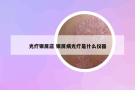 光疗银屑店 银屑病光疗是什么仪器