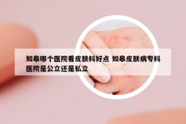 如皋哪个医院看皮肤科好点 如皋皮肤病专科医院是公立还是私立