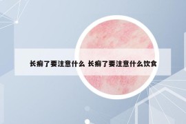 长癣了要注意什么 长癣了要注意什么饮食