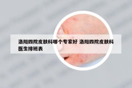 洛阳四院皮肤科哪个专家好 洛阳四院皮肤科医生排班表