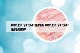 脚背上长了好多红色的点 脚背上长了好多红色的点很痒