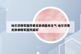 哈尔滨哪家医院看皮肤病最有名气 哈尔滨看皮肤病哪家医院最好
