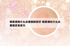 银屑病用什么水果做酵素好 银屑病吃什么水果提高免疫力
