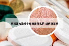 胡氏正方治疗牛皮癣用什么药 胡氏康复堂