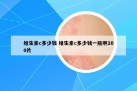 维生素c多少钱 维生素c多少钱一瓶啊100片
