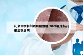 礼来生物制剂银屑病价格 2020礼来新药根治银屑病