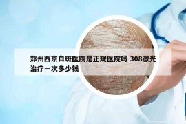 郑州西京白斑医院是正规医院吗 308激光治疗一次多少钱