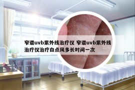 窄谱uvb紫外线治疗仪 窄谱uvb紫外线治疗仪治疗白点风多长时间一次