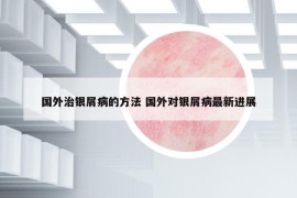 国外治银屑病的方法 国外对银屑病最新进展