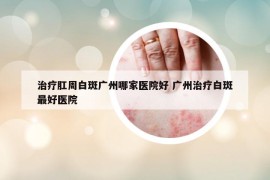治疗肛周白斑广州哪家医院好 广州治疗白斑最好医院