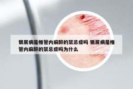 银屑病是椎管内麻醉的禁忌症吗 银屑病是椎管内麻醉的禁忌症吗为什么