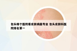 包头哪个医院看皮肤病最专业 包头皮肤科医院排名第一