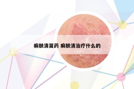 癣肤清苗药 癣肤清治疗什么的