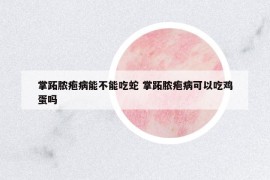 掌跖脓疱病能不能吃蛇 掌跖脓疱病可以吃鸡蛋吗