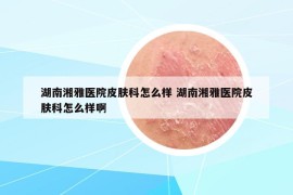 湖南湘雅医院皮肤科怎么样 湖南湘雅医院皮肤科怎么样啊