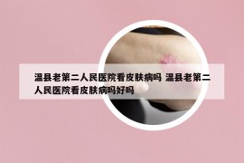 温县老第二人民医院看皮肤病吗 温县老第二人民医院看皮肤病吗好吗